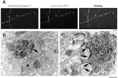 α-Synuclein in the Synaptic Vesicle Liquid Phase: Active Player or Passive Bystander?